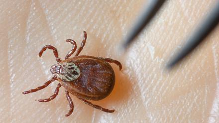 Zeckensaison in Berlin: Lageso verzeichnet mehr Borreliose-Fälle als früher