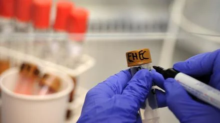 Verbindung zu Infektionen im Nordosten unklar: Fleischproduzent ruft Zwiebelmettwurst wegen Ehec-Gefahr zurück