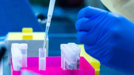 Schweiz ganz oben: Deutschland fliegt aus den Top 10 der innovativsten Länder